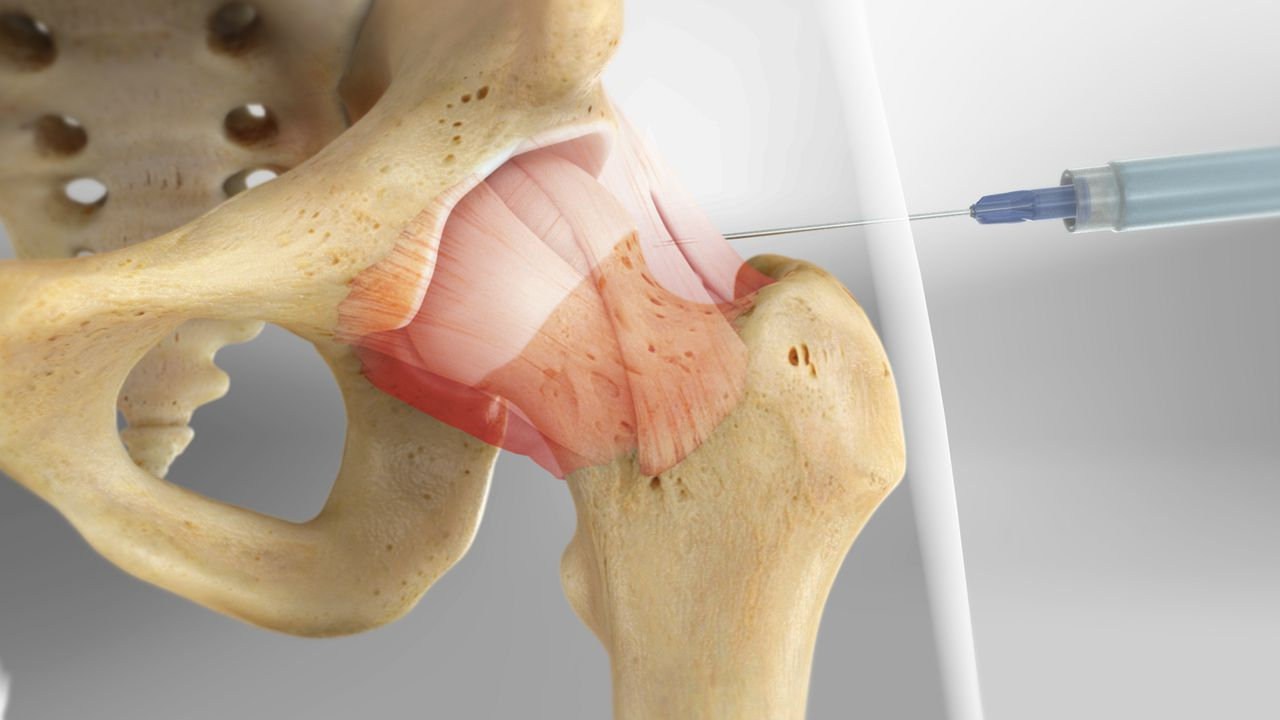 jointinjhip_1280 Il Dott. Stefano Barbero unisce la competenza diagnostica all'efficacia interventistica. Oltre all'esecuzione di un'ampia gamma di Ecografie (addominali, tiroidee, muscolo-scheletriche e altro), il Dottore è specializzato nell'effettuare Infiltrazioni Ecoguidate.